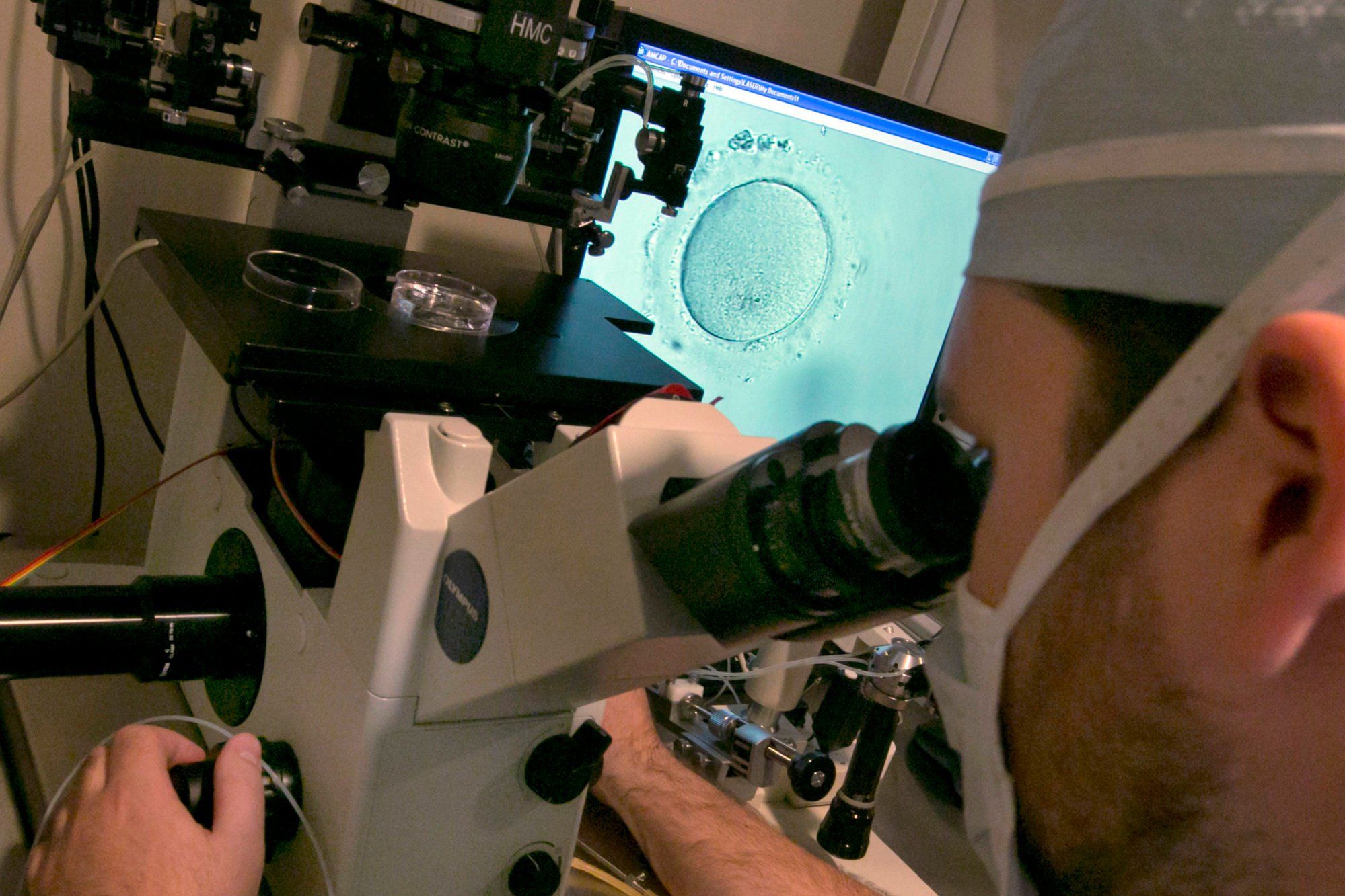 An embryo is viewed through a microscope in New York in October 2013. Photo: AP