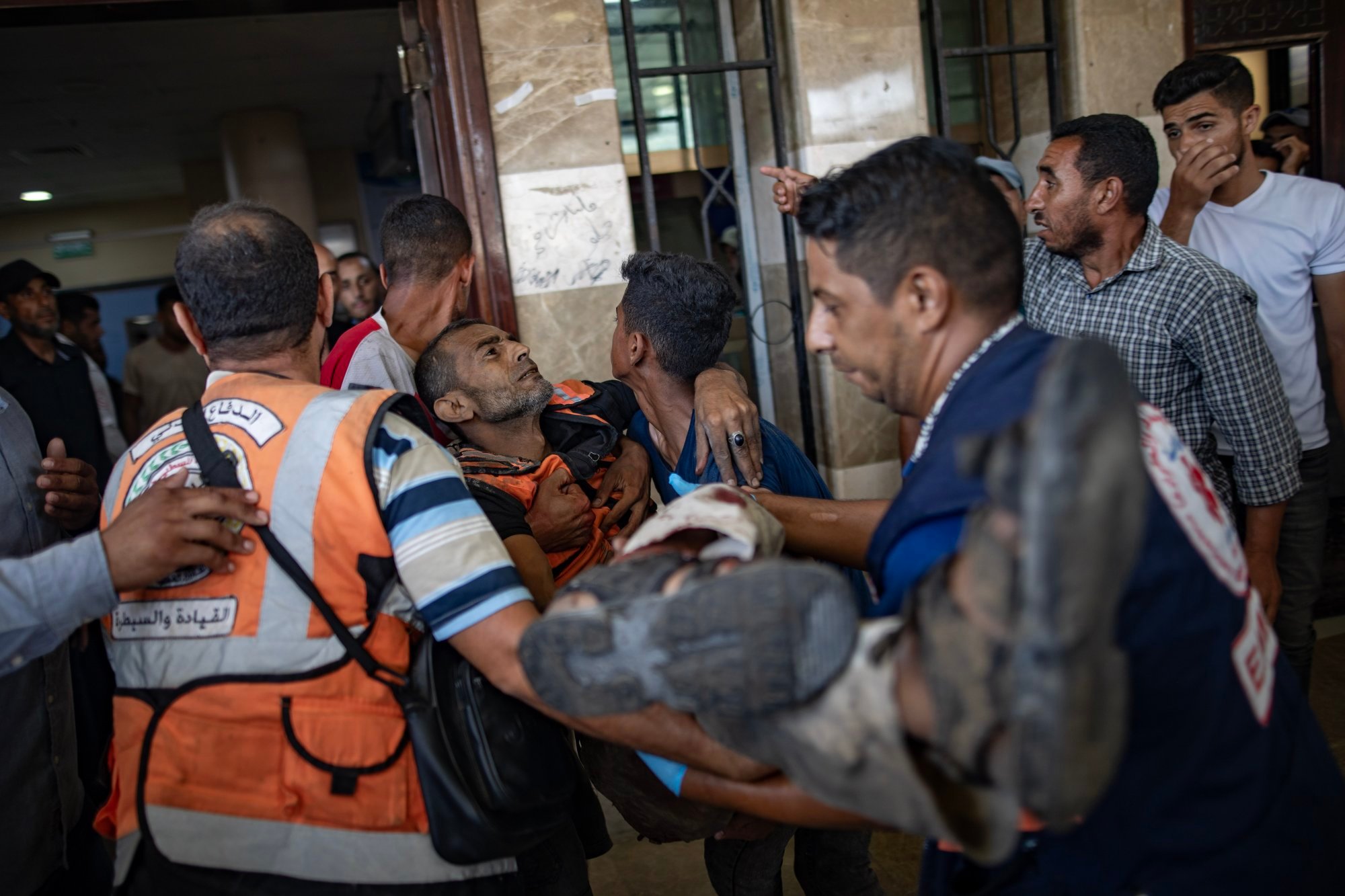 Wounded people are transported to Nasser Hospital after an Israeli raid on the tents of displaced people in the Al-Mawasi area of Khan Younis in the southern Gaza Strip on Saturday. Photo: EPA-EFE