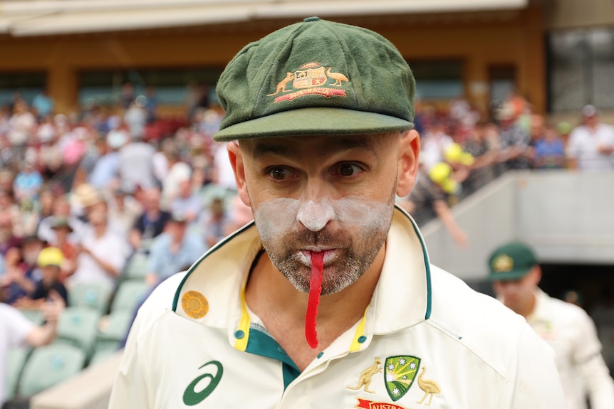 Nathan Lyon eats a snake lolly with it sticking out of his mouth