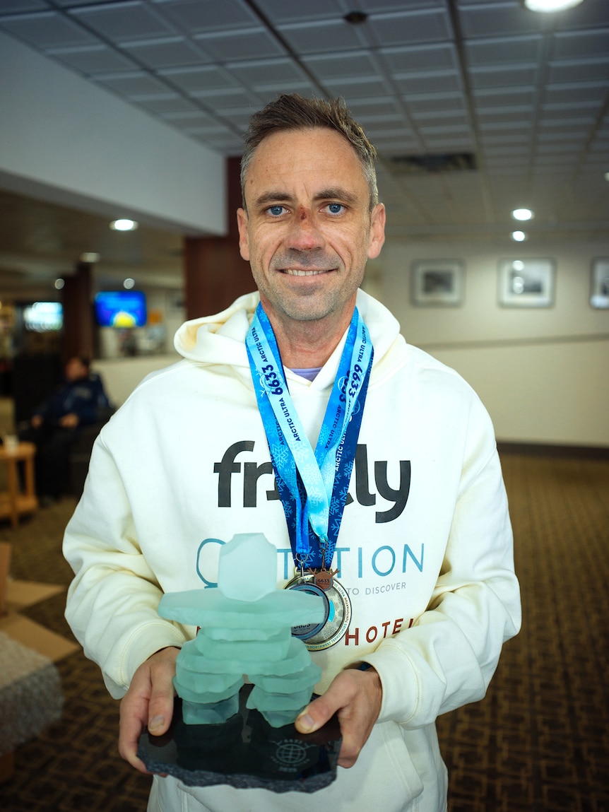 A man in a jumper with small wound on bridge of nose holds trophy.