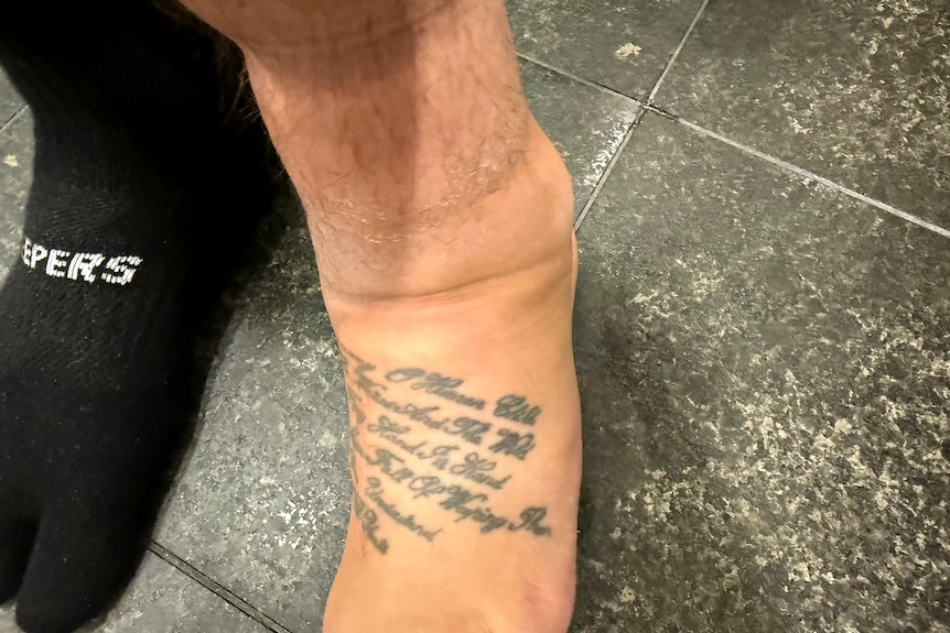 A man's swollen foot with tattooed writing on it.