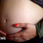 More than 100 maternity staff sue NHS over gas exposure
