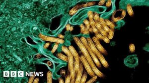 New outbreak of Ebola kills 65 in eastern DR Congo