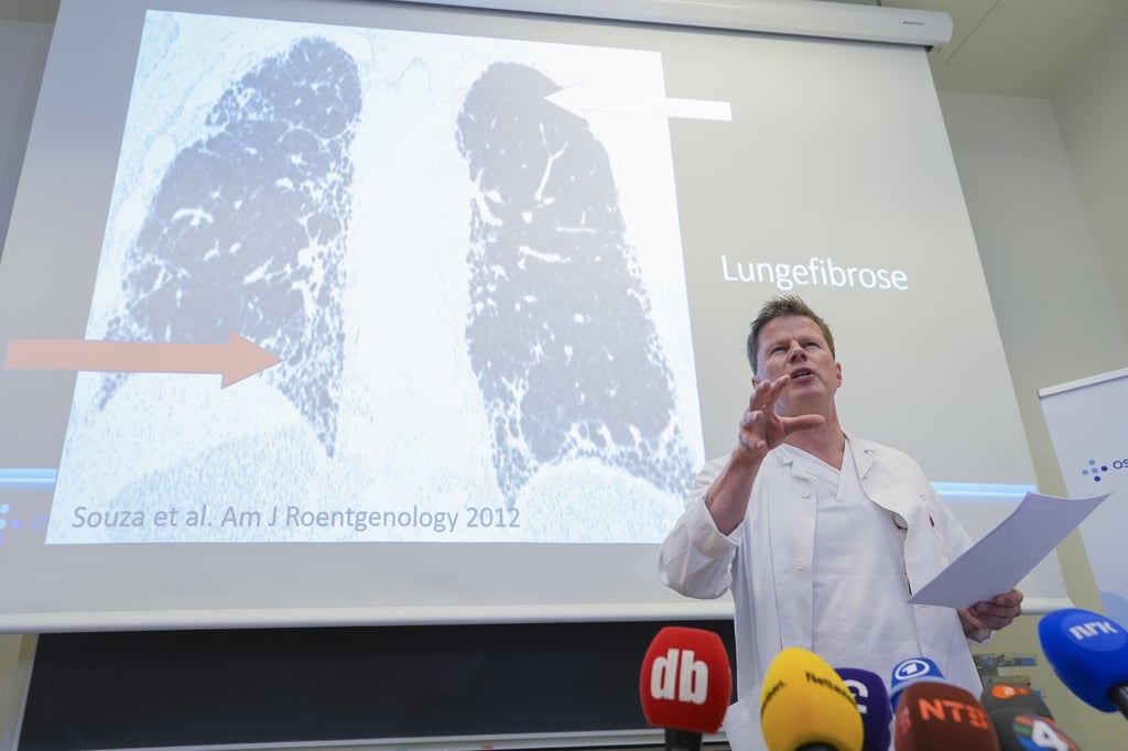 Chief physician and lung specialist Are Holm speaks about the health condition of Norway’s Crown Princess Mette-Marit at Rikshospitalet hospital in Oslo on Friday. Photo: EPA