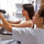 Breast cancer checks missing most women under 50 who are at risk, says study