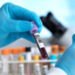 England set to be one of the first countries to eliminate hepatitis C