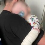 Nursery fined after baby boy burned by bleach